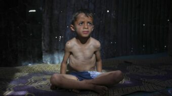 Human annihilation: Starving Gaza’s children to death is Israel’s latest tactic