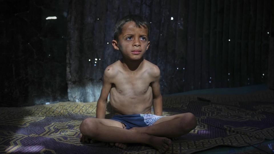 Human annihilation: Starving Gaza’s children to death is Israel’s latest tactic